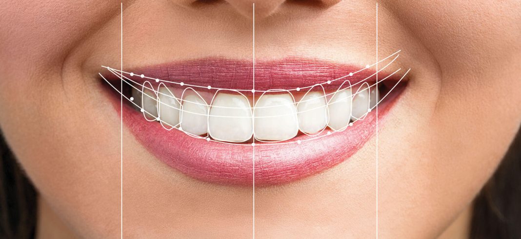 Ortodontik tedavi diş teli çeşitleri nelerdir?