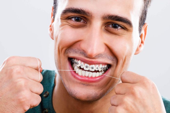 Metal diş teli tedavisi hakkında bilinmesi gerekenler