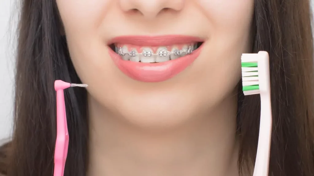 Diş teli bakımı nasıl yapılır?